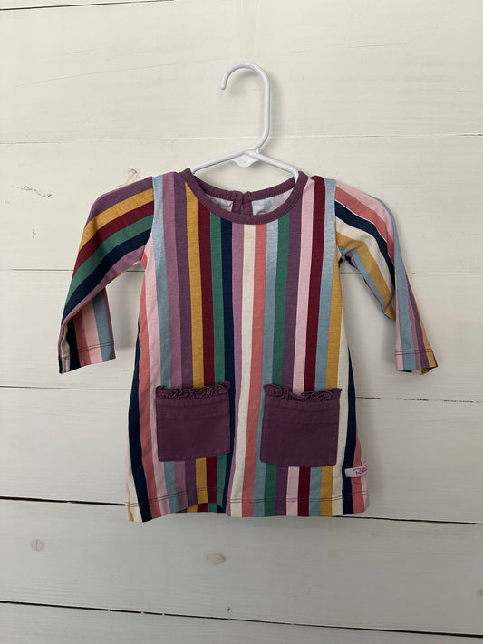 Ruffle Butts Striped Tunic